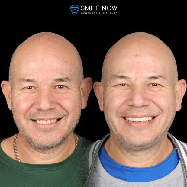 Images Smile Now Milwaukee Dentures and Implants