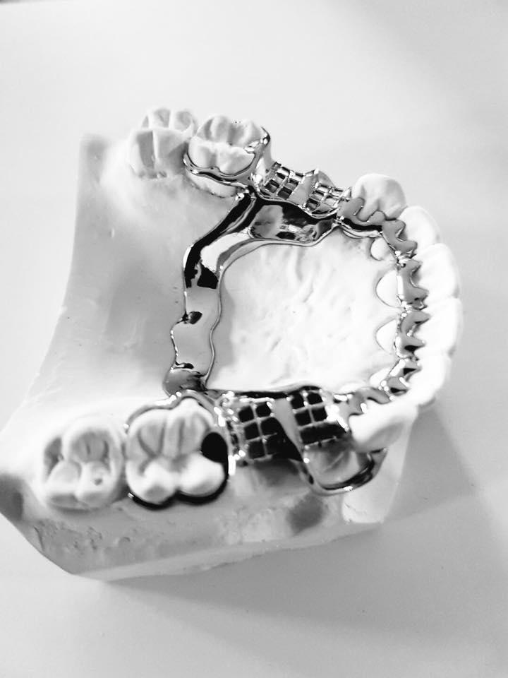 Images Chrome Cast Dental Laboratory