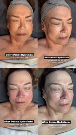 Images Skincare by Rosie