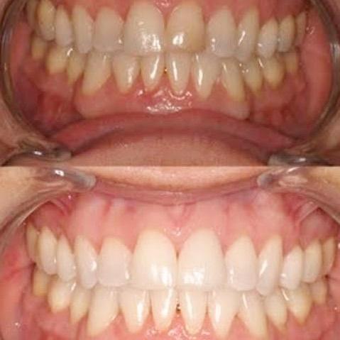 Images Smiles By Eddie: Dr. Edmond Ahdoot DDS