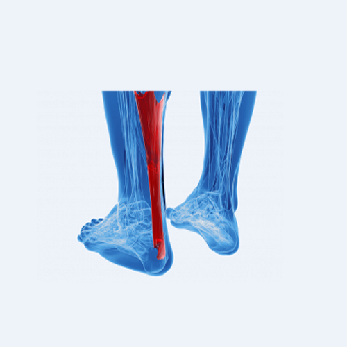 Orthopädie-Technik Trojahn, Hochstrasse 137 in Pfäffikon