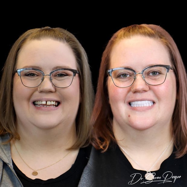 Images Smile Now Denver Dentures and Implants