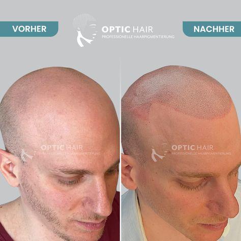 Haarpigmentierung Köln | OpticHair, Höninger Weg 176 in Köln