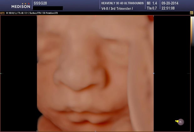 Images Heavenly 3D 4D Ultrasounds-Upland