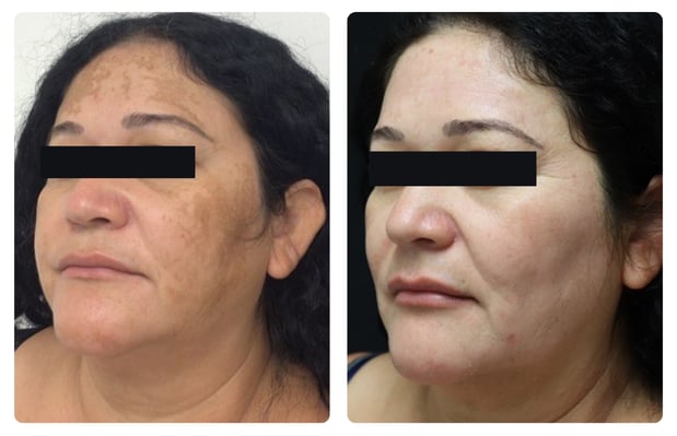 Images Glösense Dermatology & Aesthetic