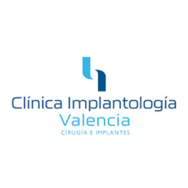 Clinica Implantologia Valencia Logo
