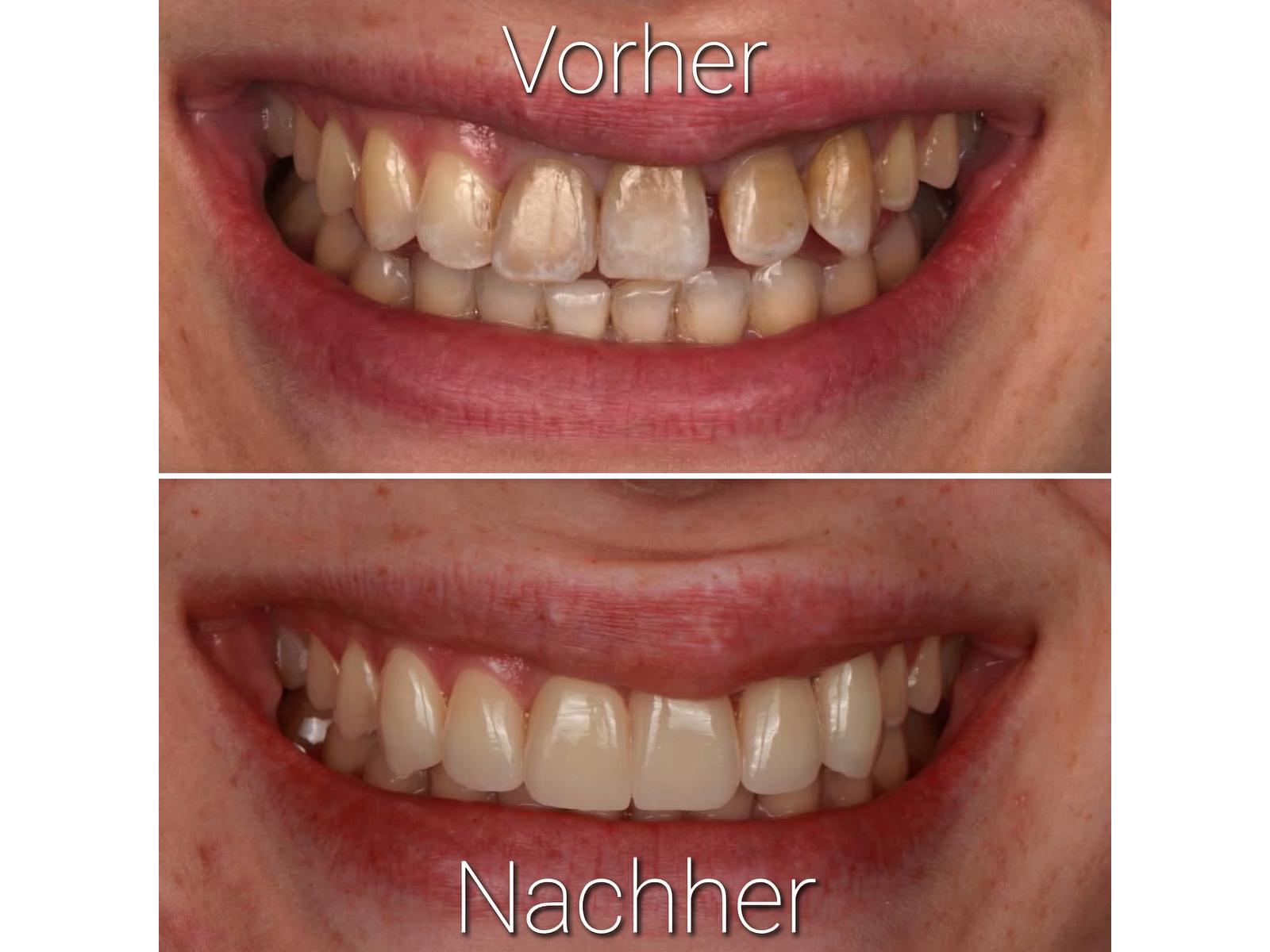 Dr. Vogtner - Zahnärzte, Bergbräustraße 2 in Ingolstadt