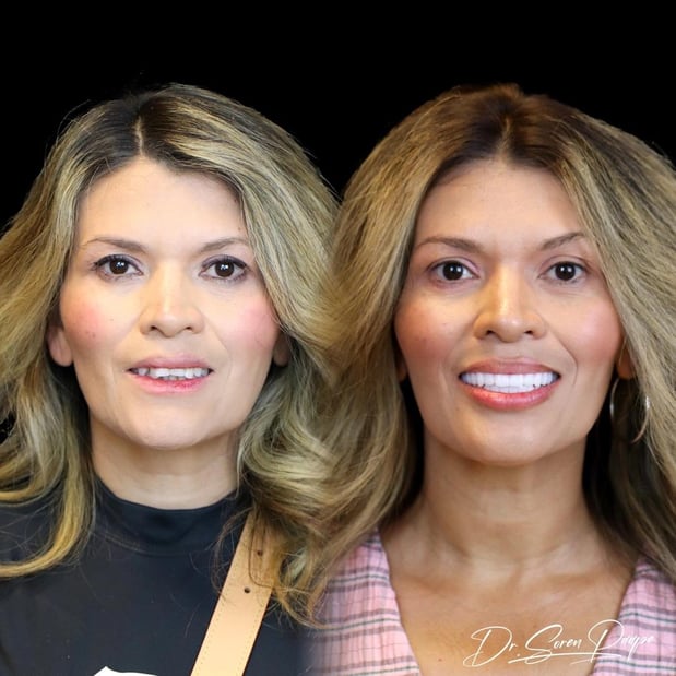 Images Smile Now Denver Dentures and Implants
