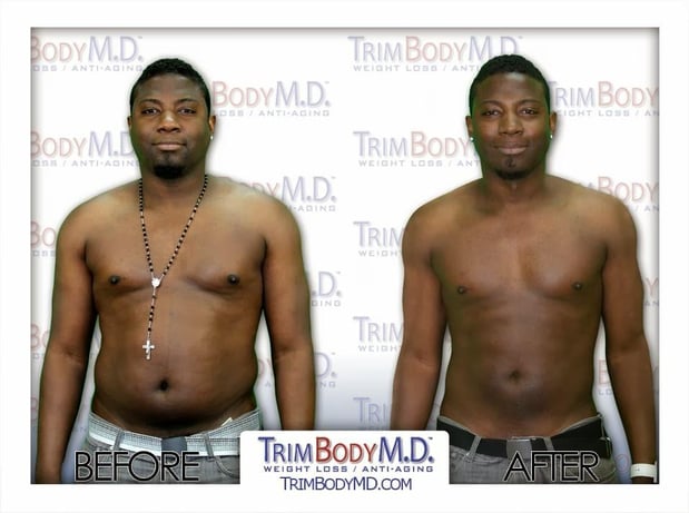 Images TrimBody M.D. Summerlin