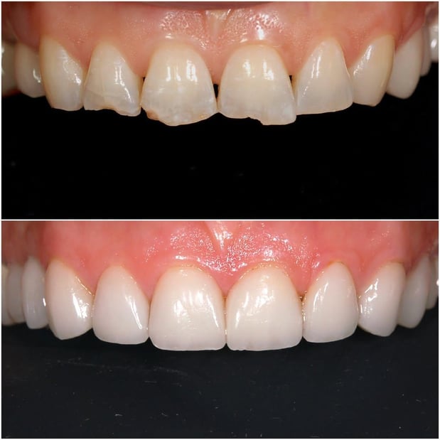 Images Pacific Dental Care