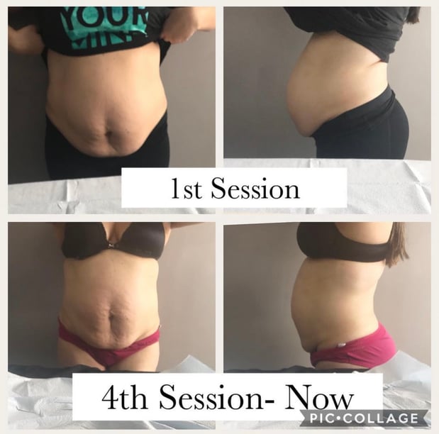 Images Queen Divas Body Sculpting