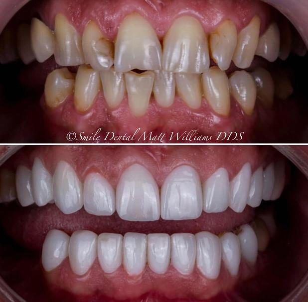 Images Smile Dental