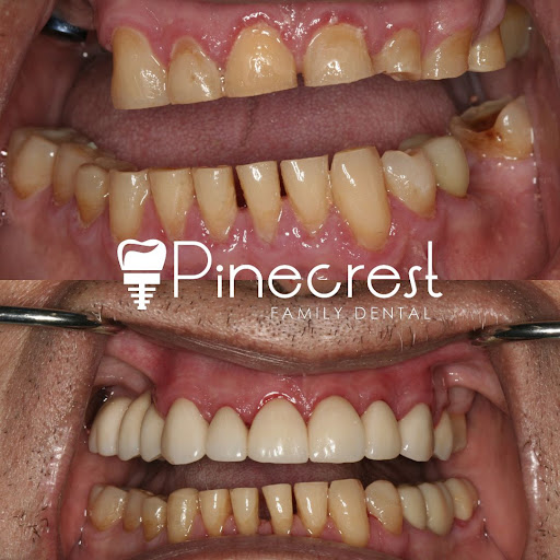 Images Pinecrest Family Dental