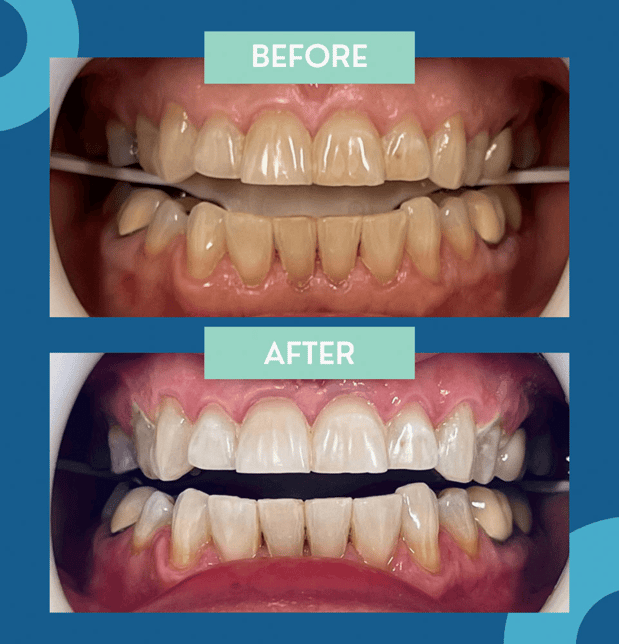 Images Riverside Family Dental