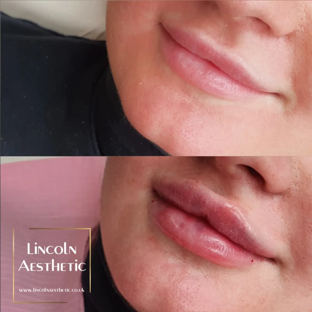 Images Lincoln Aesthetic