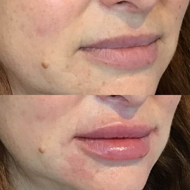 Images BCRN Aesthetics MedSpa