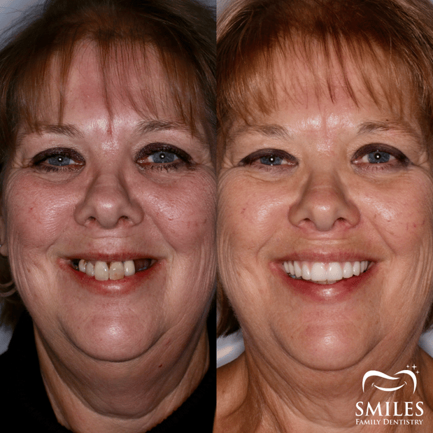 Images Brunswick Smiles Family Dentistry Implant, Oral Surgery, and Cosmetic Dentist