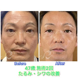 Images Blue beedro -メンズ美肌科学研究所-