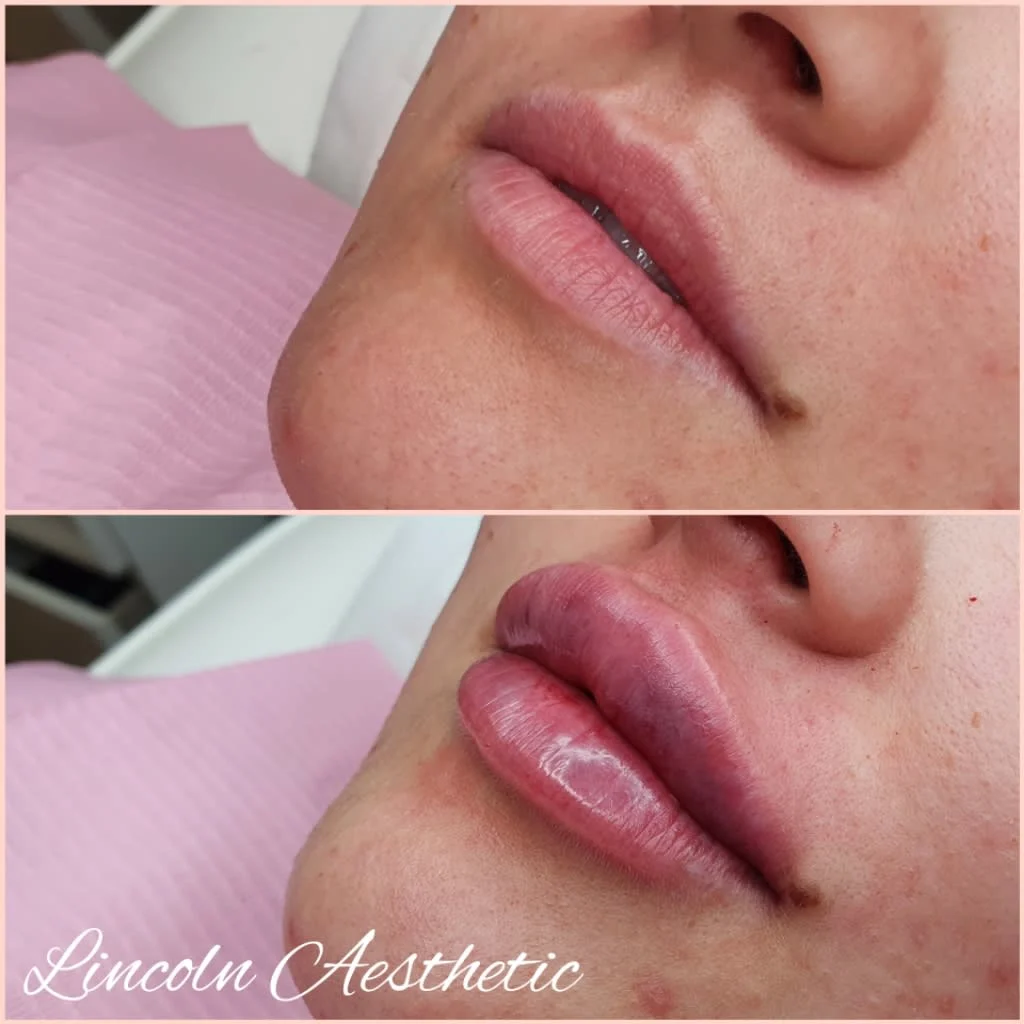 Images Lincoln Aesthetic