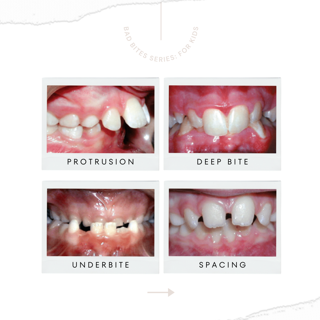 Before and After Results at Pioneer Hills Dental | Aurora, CO Pioneer Hills Dental Aurora (303)766-8811