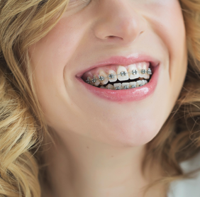 Sparkle Dental in Warren, MI Offers Services Beyond Dentistry Including Orthodontics