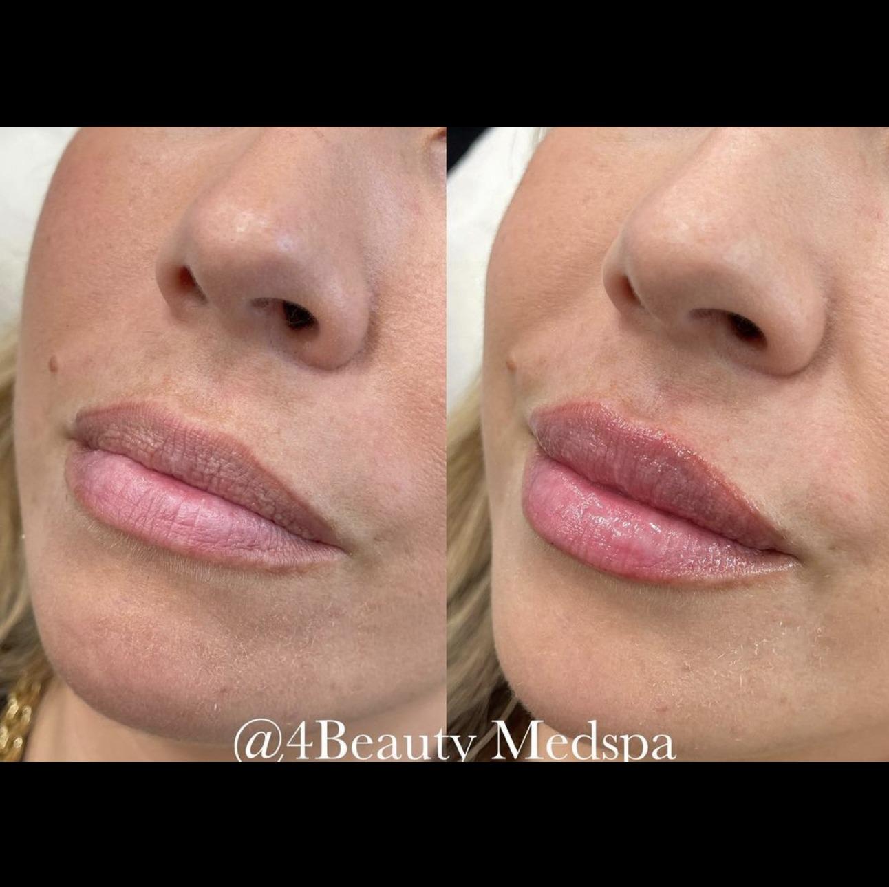 4 Beauty Aesthetics Institute for Plastic Surgery: Dr. Constantino Mendieta