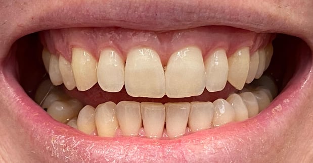 Images Piedmont Oaks Dental