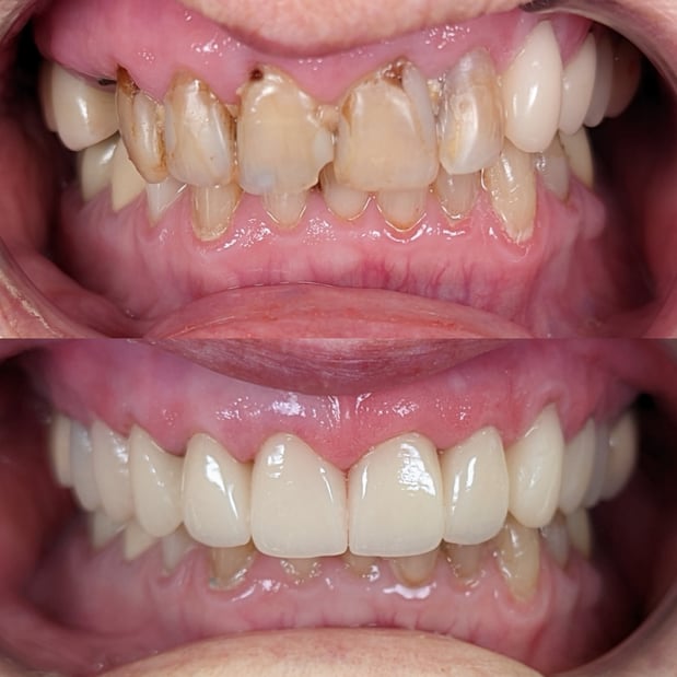 Images South Weber Dental