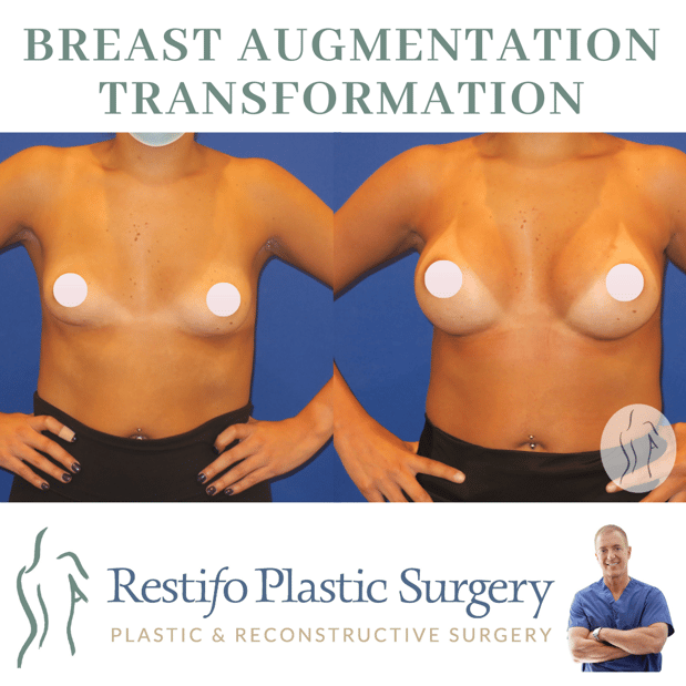 Images Restifo Plastic Surgery