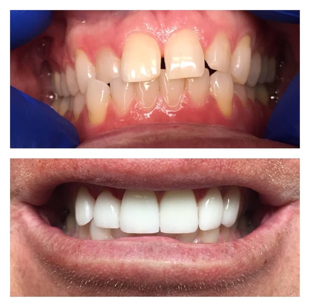 Images Paladin Dental