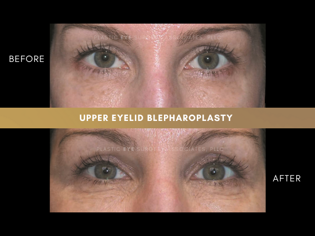 Images Plastic Eye Surgery Associates, PLLC