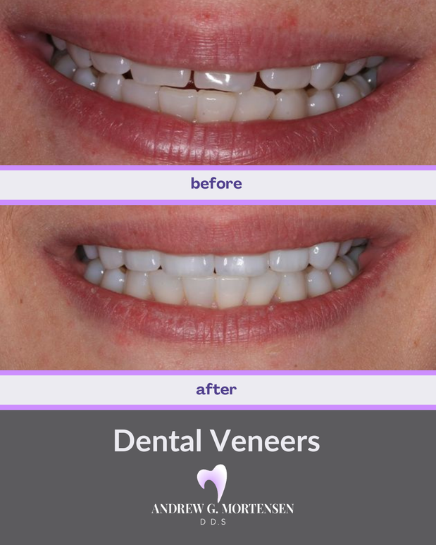 Images Andrew G. Mortensen, DDS
