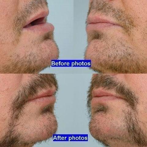 Images ForHair NYC Restoration Clinic - Dr. John Cole