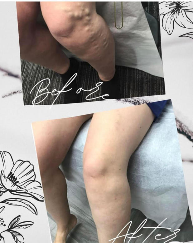 Images Vein Specialist Centers - Hawthorne