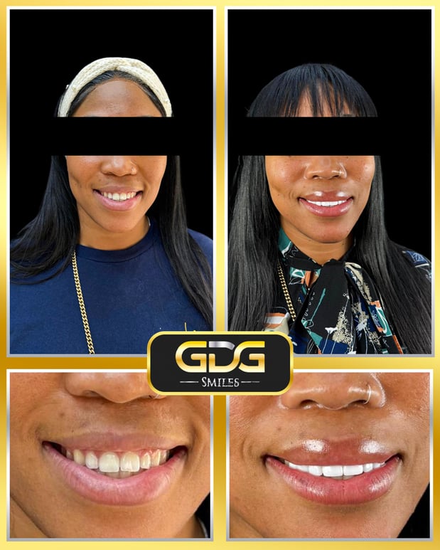 Images GDG Smiles