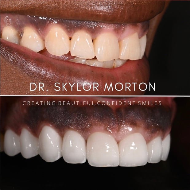 Images Nashville Wisdom Teeth and Implant Solutions
