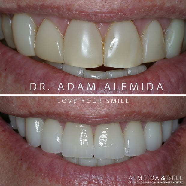 Images Almeida & Bell Dental Lone Tree - General, Cosmetic, and Implant Dentistry