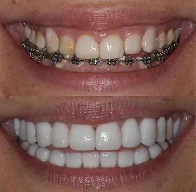 Images D'Angelo/Hoffman/Olson La Jolla Dentistry