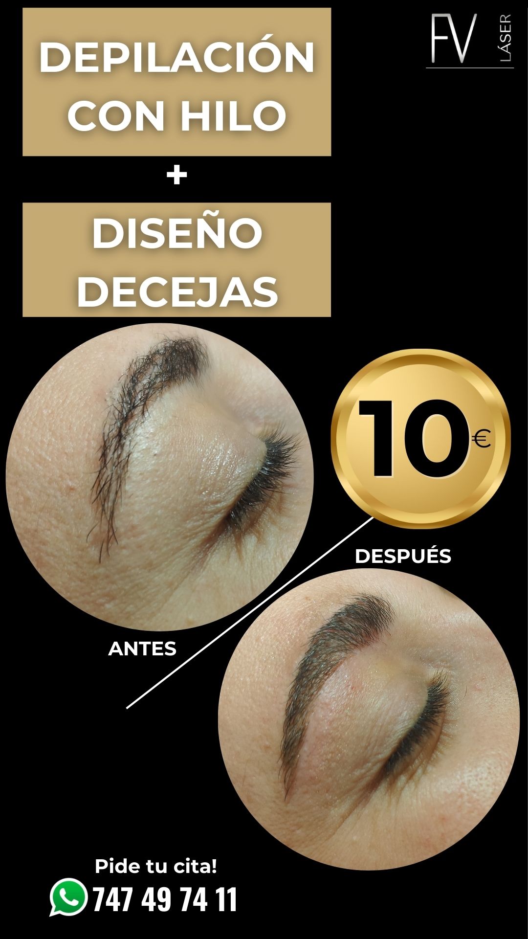 Images Fv Láser Nails Beauty