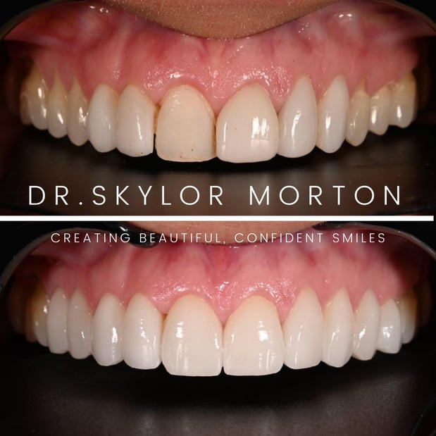 Images Nashville Wisdom Teeth and Implant Solutions