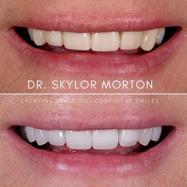 Images Nashville Wisdom Teeth and Implant Solutions