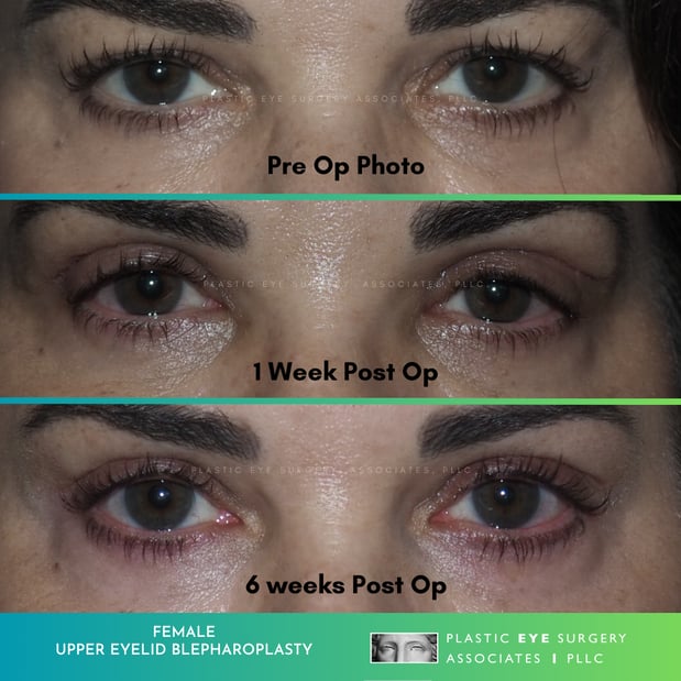 Images Plastic Eye Surgery Associates, PLLC