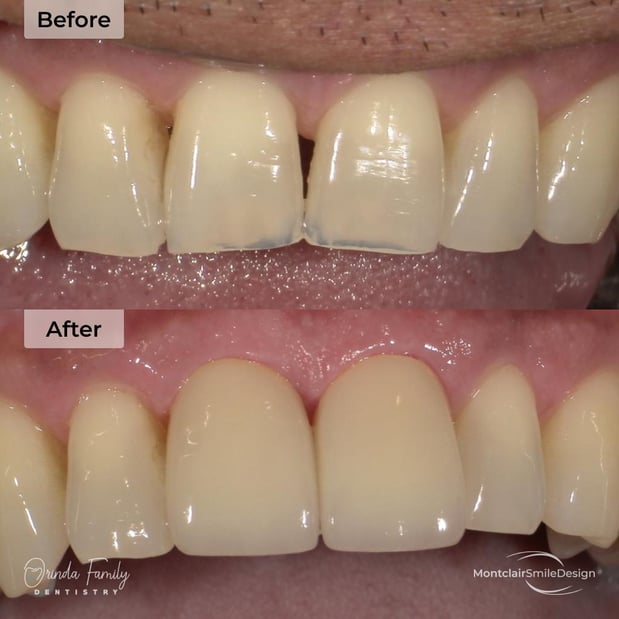 Images Orinda Family Dentistry