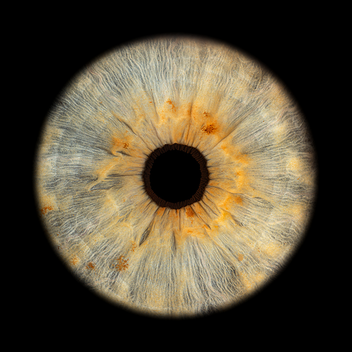 Bilder Müller Optik AG