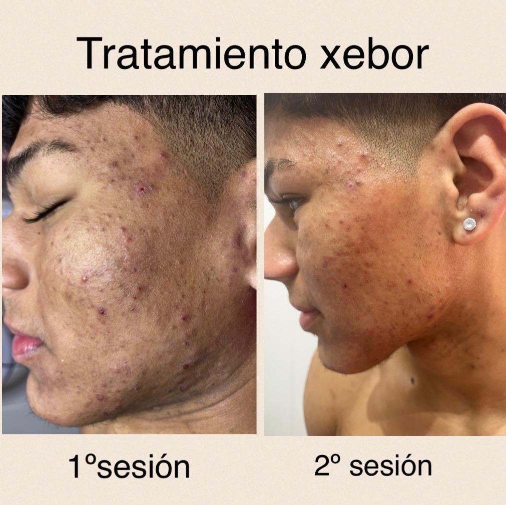 Images Centro De Estética Avanzada Y Láser Verónica Vico