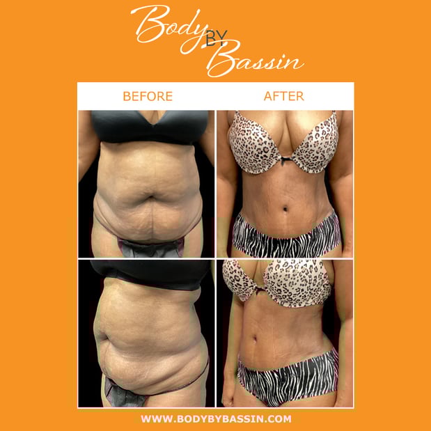 Images Body By Bassin Melbourne