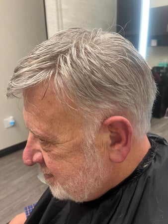 Images Hair restoration by Melz