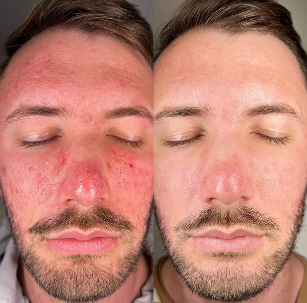 Images Face of Jules