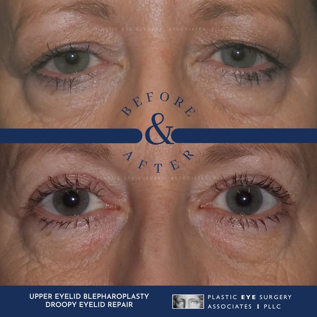 Images Plastic Eye Surgery Associates, PLLC