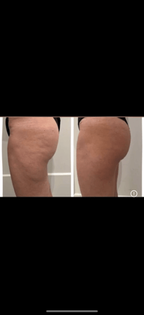 Images Body Lounge Park Cities - Whole Body Wellness & Medical Aesthetics, Dallas, TX